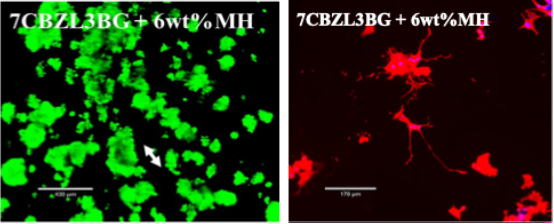 Neural cells show good attachment (left) and axonal growth (right) on drug-loaded scaffolds.